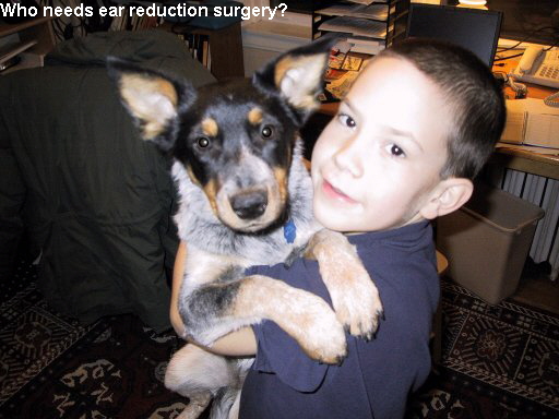 Who needs ear reduction surgery?